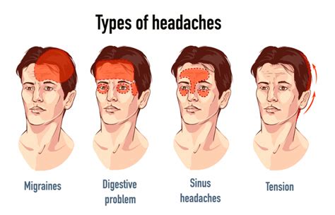 Why do I have a sharp headache?